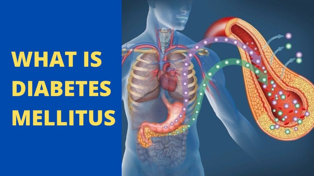 Diabetes Mellitus