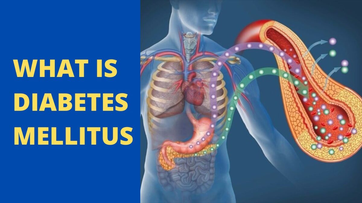 What is Diabetes Mellitus Complete Information on the disease